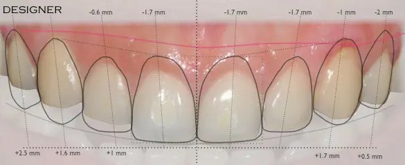 mejor dentista en miami, carillas de porcelana en miami, Botox miami, costo del tratamiento de conducto en miami, elevación de seno nasal en miami, mejores carillas en miami, mejor dentista del sur de florida, mejor dentista cosmético en miami, mejor atención dental en miami, sage dental